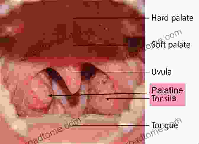 A Close Up Of The Tongue And Tonsils, Highlighting The Potential Signs Of Cancer. What You Need To Know About Tongue And Tonsil Cancer It S Your Life Live It