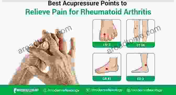 Acupuncture For Arthritis Relief Heal Arthritis Naturally: 18 Natural Methods For Preventing Healing And Reversing Arthritis From Within