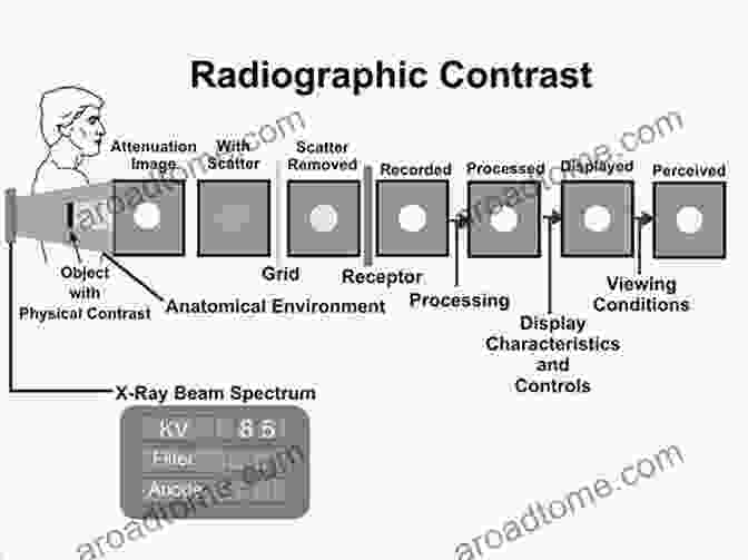 Historical Image Of The Development Of Ray Contrast Agent Technology X Ray Contrast Agent Technology: A Revolutionary History