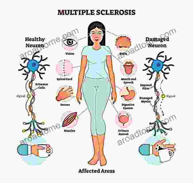 How I Reversed My Multiple Sclerosis Get Over Yourself: How I Reversed My Multiple Sclerosis