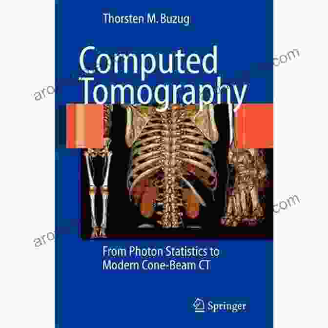 Photon Statistics To Modern Cone Beam CT Computed Tomography: From Photon Statistics To Modern Cone Beam CT