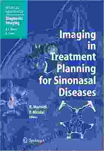 Imaging In Treatment Planning For Sinonasal Diseases (Medical Radiology)