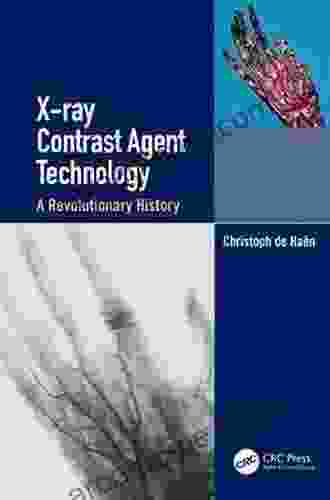 X Ray Contrast Agent Technology: A Revolutionary History