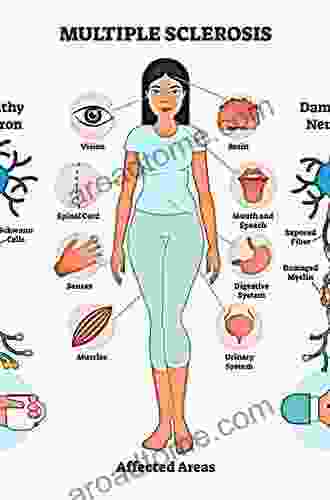 Multiple Sclerosis Prognosis: Multiple Sclerosis Causes: Multiple Sclerosis Foundation